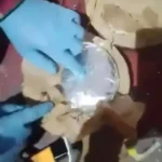 1000335379